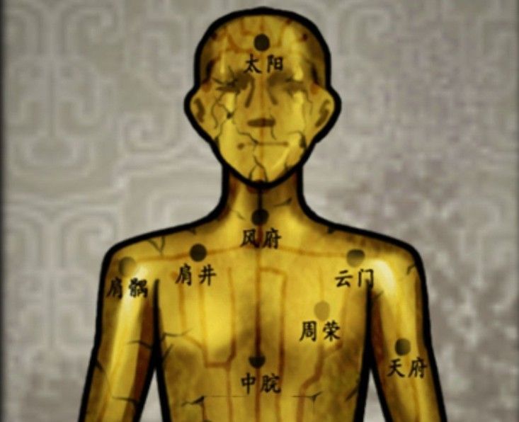 山村老屋2之废弃医院银针怎么插？告诉你详细针灸顺序轻松获取线索[多图]图片1