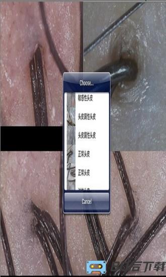 MRKV头皮检测仪